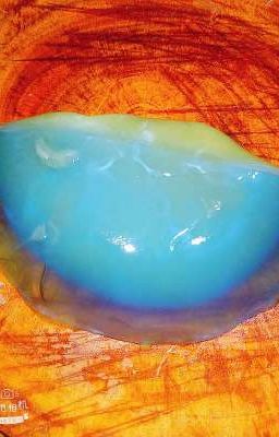 Vùng Xám Và Đại Dương Xanh